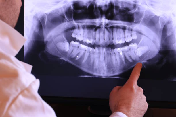 Best Holiday Emergency Dentist in Manchaca, TX