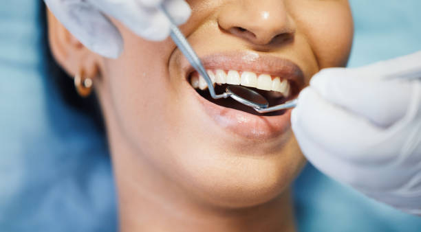 Best Emergency Dentist for Knocked-Out Tooth in Manchaca, TX