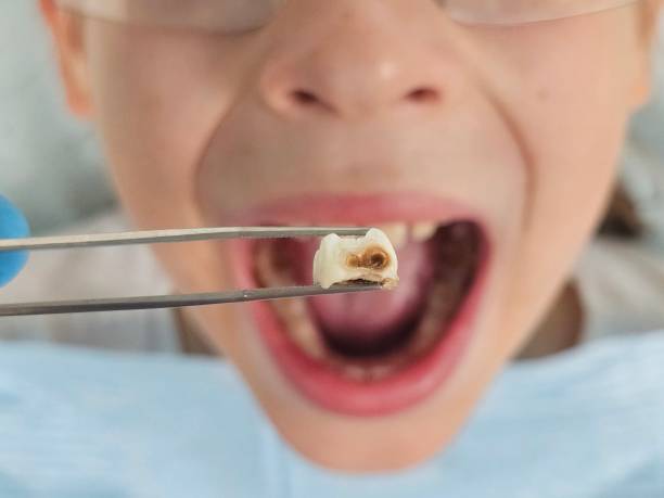 Best Pediatric Emergency Dentist in Manchaca, TX
